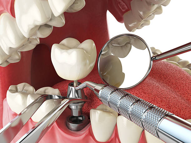 Best Urgent Tooth Repair  in Wolf Point, MT